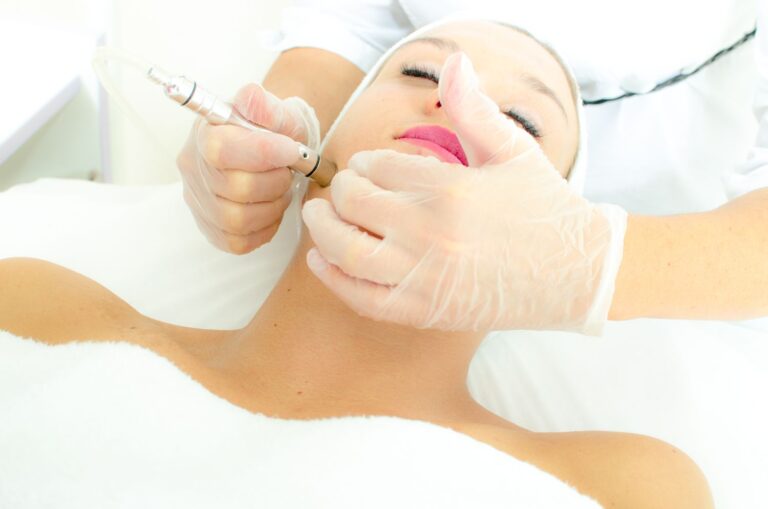 Face Skin Benefits Of Microdermabrasion