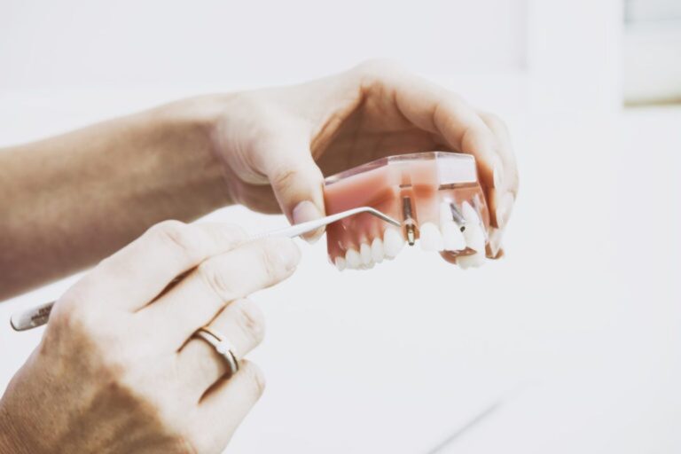 Best Dental Insurance That Covers Dentures In 2023 • Benzinga