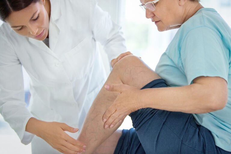 Causes And Prevention Of Varicose Veins And Varicose Veins