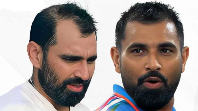 Celebrity Hair Transplant Surgeons Reveal The Secret Behind Mohammed Shami's