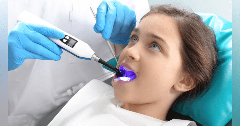 Dental Sealants: Product Comparison