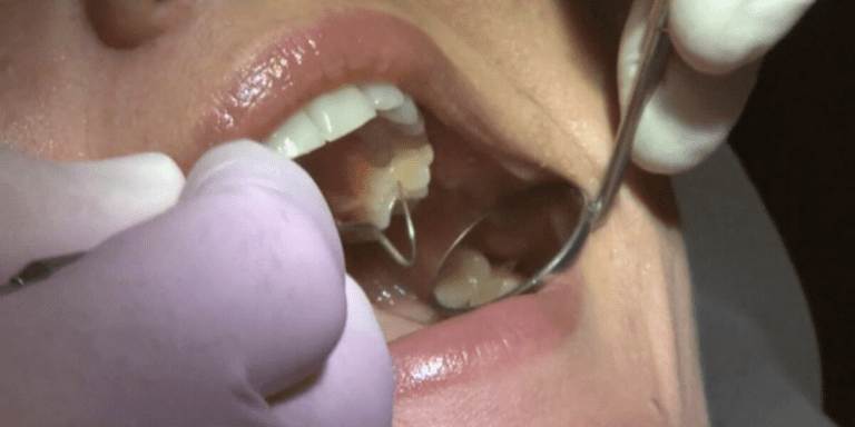 Low Income New Yorkers Earn The Right To A Root Canal