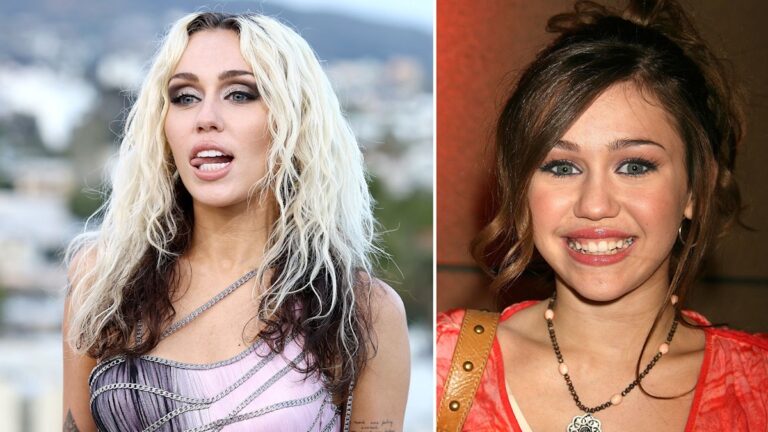 Miley Cyrus Smile Makeover: What Has She Done To Her