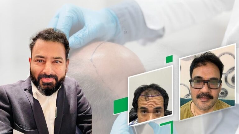 Redefine The Hair Transplant And Plastic Surgery Center