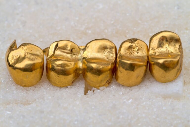 What Is A Gold Dental Crown?