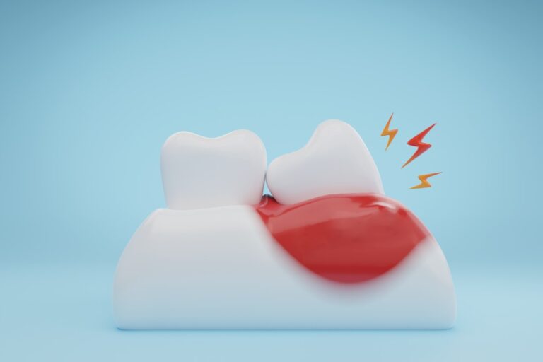 Dentist: Everything You Want To Know About Wisdom Teeth Removal