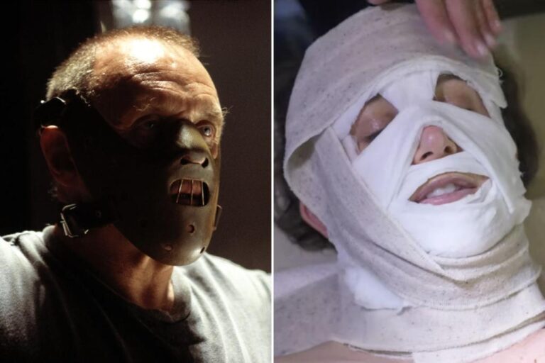 'hannibal Lecter Facials' Add Shock For A Youthful Glow —