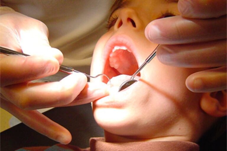 Ni Dental Crisis: Stormont Deadlock Set To Add To Problems