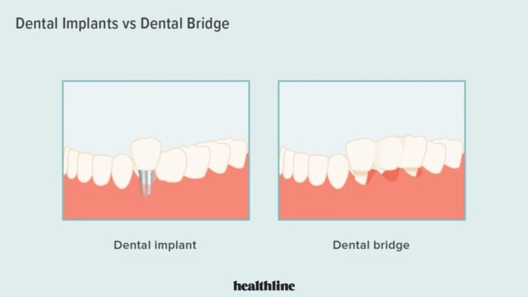 Understanding The Differences, Advantages And Disadvantages