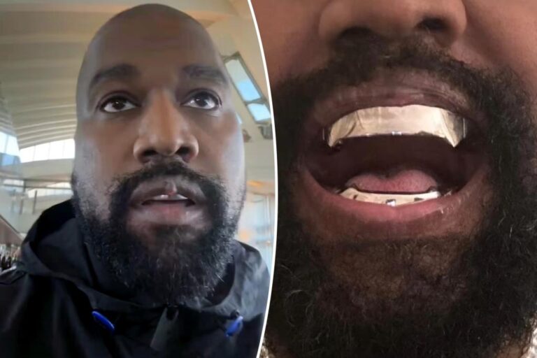 Celebrity Dentist Weighs In On Kanye West's Apparent Lip 'growth'
