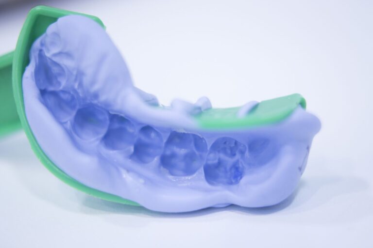 Digital Vs Traditional Dental Impressions