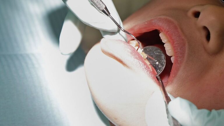 Lawmakers Agree To Ban Mercury Based Cavity Filling By 2025