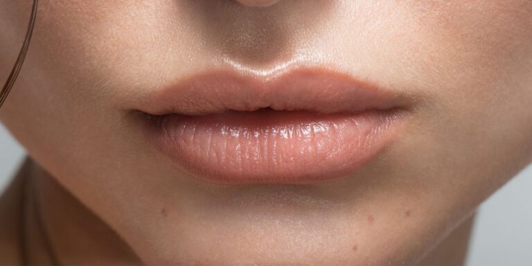 Subtle Lip Filler: A Complete Guide
