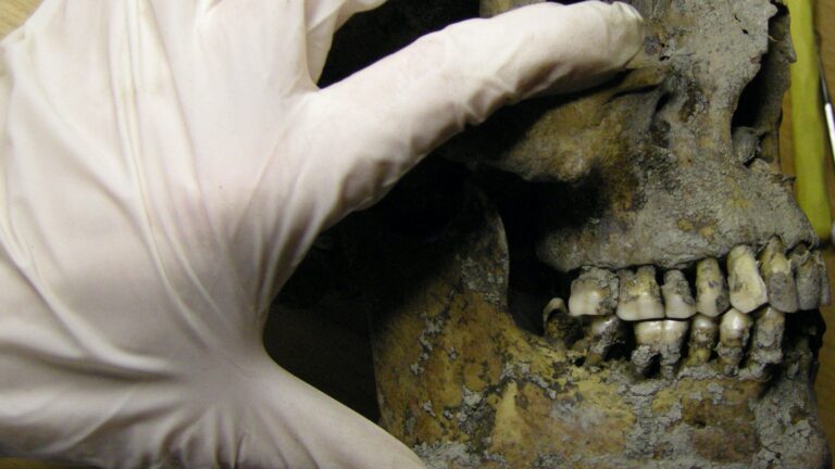 The Vikings Had Terrible Teeth | History