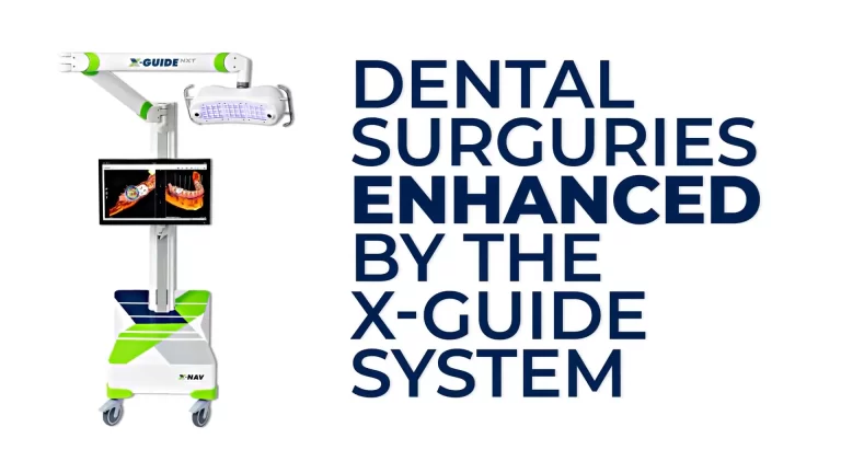 Dental Surgery Enhanced By The X Guide System: Elevating Dentist And