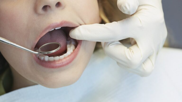 Dentists Are Concerned About Tooth Extractions From Children