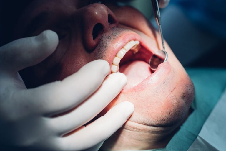 Do We Need Our Wisdom Teeth Removed? Experts Say This