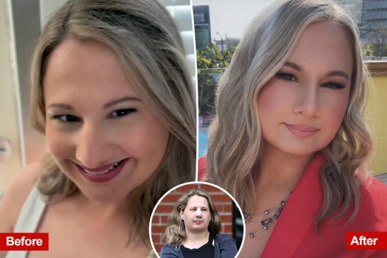 Gypsy Rose Blanchard Shows Off New Nose After Plastic Surgery