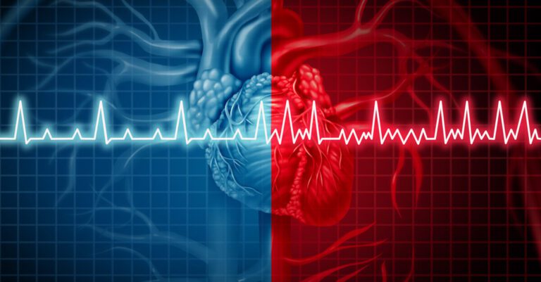 Periodontal Disease Reduces Recurrence Of Atrial Fibrillation