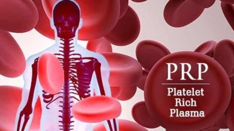 Platelet Rich Plasma Therapy: What Is It? How It Is