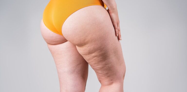 Anti Cellulite Products Are Big Business – But Here's What The
