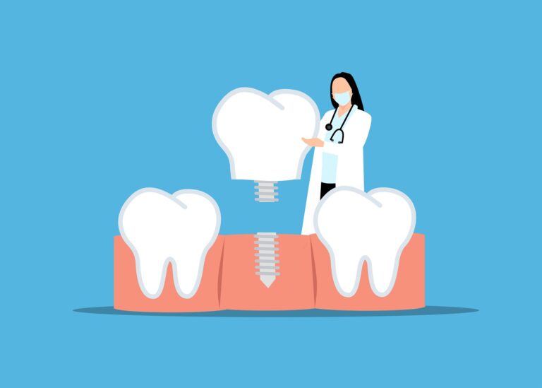 Can Dental Implants Be Placed In Patients With Head And