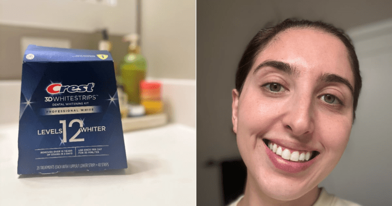 Crest Whitestrips Review With Photos