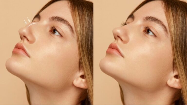 Do You Want To Achieve Harmonious Facial Contours? Learn All