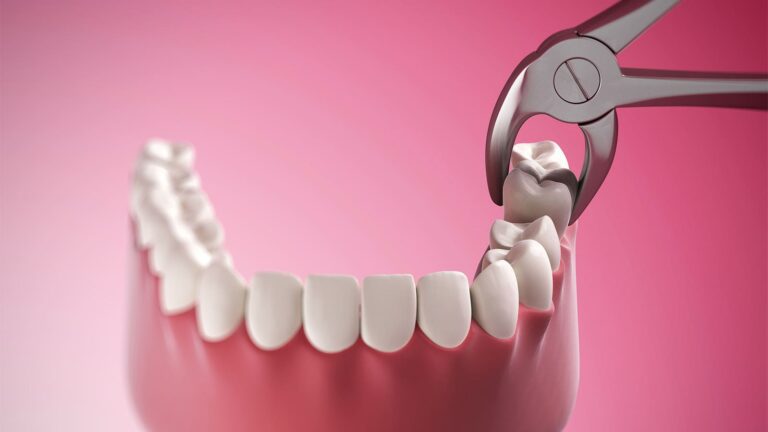 Missing Teeth And Joint Pain? Ra May Be Imminent