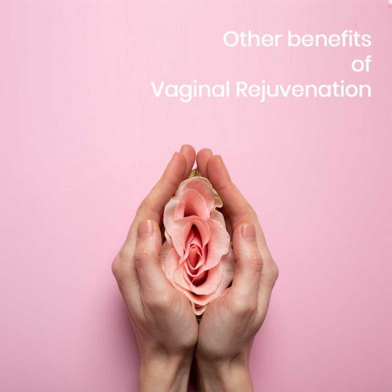 Vaginal Rejuvenation Market Growing Popularity & Emerging Trends | Alma