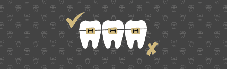 5 Myths Orthodontists Want You To Revise