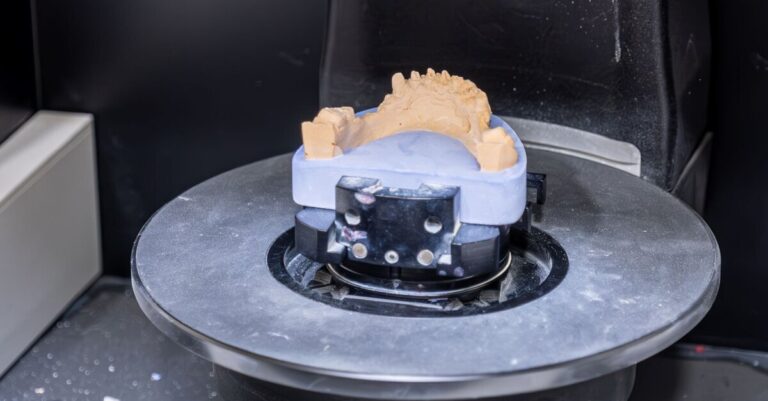 Complete Dentures From 3d Printed Shell For Implant Design