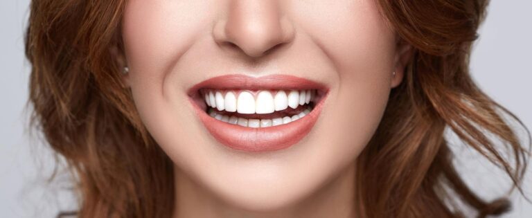 Inside The Polarizing World Of Dental Veneers