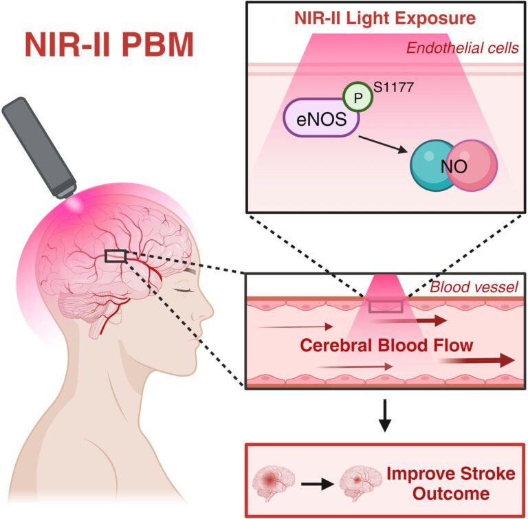 Non Invasive Laser Therapy Could Be An Effective New Treatment For