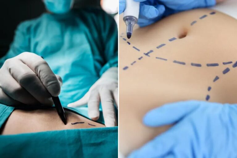 The Most Popular Plastic Surgery Procedures In America