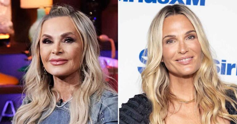 Tamra Judge Reacts To Molly Sims' Chemical Peel Review