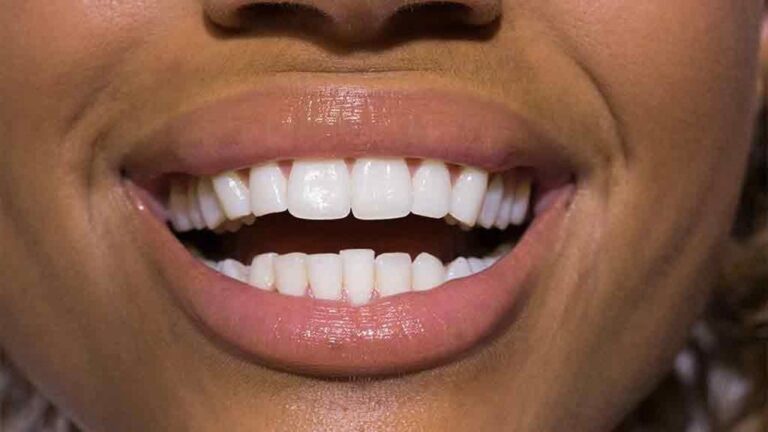 Teeth Whitening In Beauty Salons Is Illegal, Nda President Says